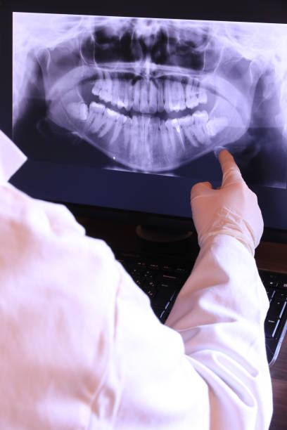 Best Emergency Tooth Extraction in Tracy, CA