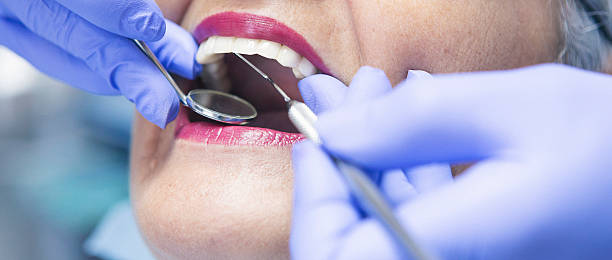 Best Emergency Broken Tooth Repair in Tracy, CA