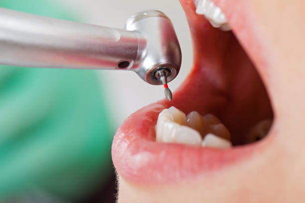 Best Urgent Dental Care in Tracy, CA